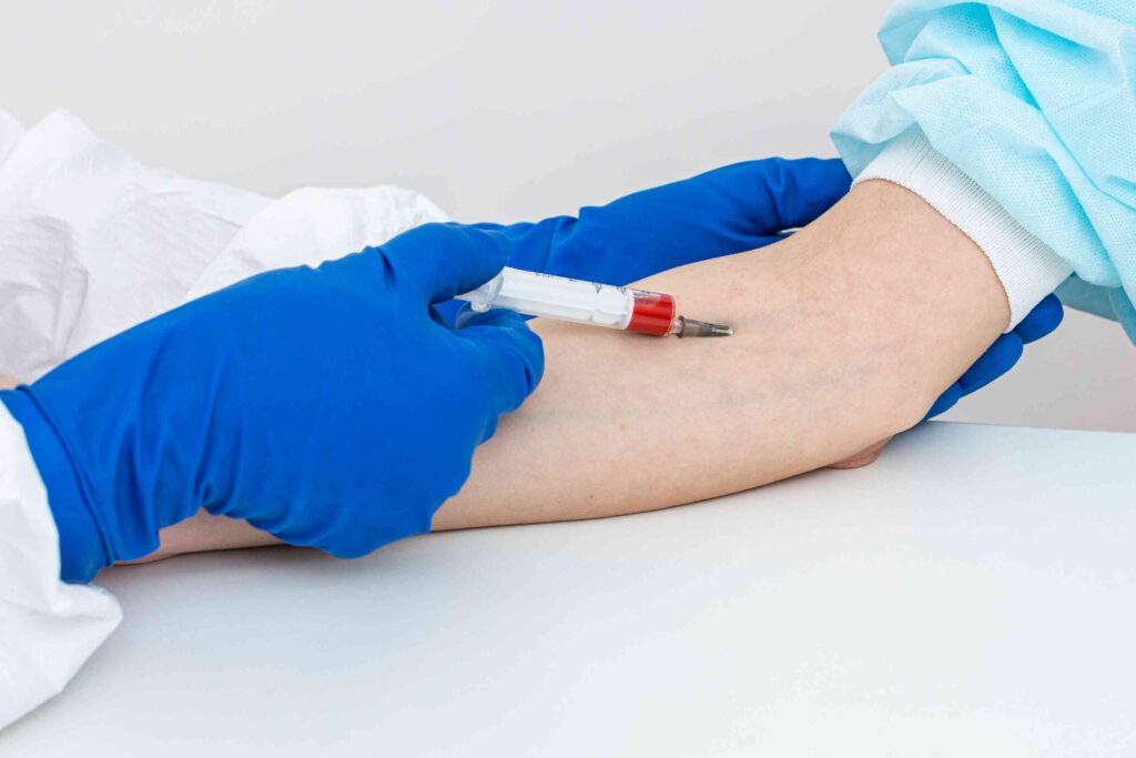 blood examination-Gamca Health Cochin