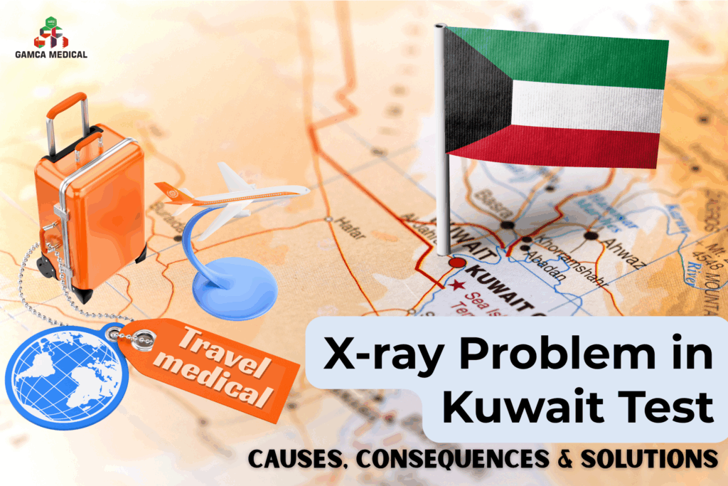 X-ray Problem in Kuwait Test: Causes, Consequences & Solutions