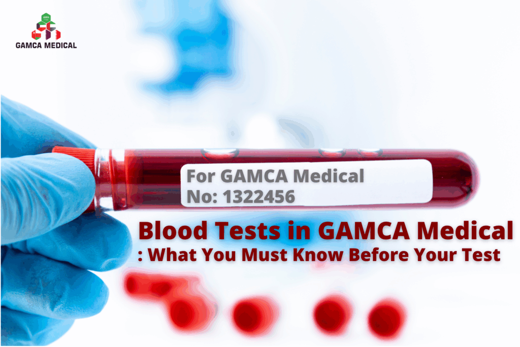 Blood Tests in GAMCA Medical: What You Must Know Before Your Test