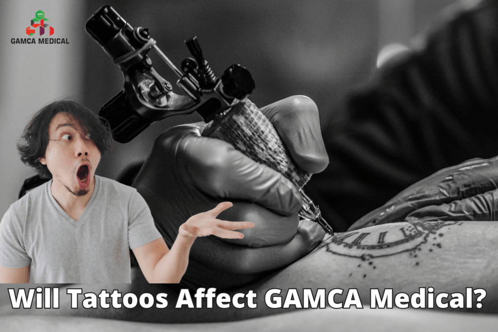 Will Tattoos Affect GAMCA Medical? Everything You Need to Know