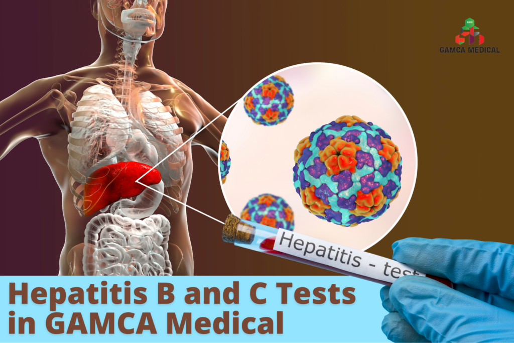 Hepatitis B and C Tests in GAMCA Medical – updated Complete Guide
